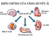 TIN VUI CHO NGƯỜI CAO HUYẾT ÁP - ĐÃ CÓ TRÀ THẢO DƯỢC HẠ HUYẾT ÁP